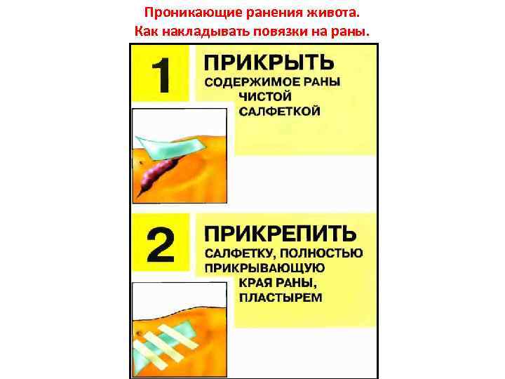 Проникающие ранения живота. Как накладывать повязки на раны. 