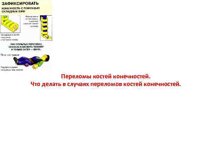 Переломы костей конечностей. Что делать в случаях переломов костей конечностей. 