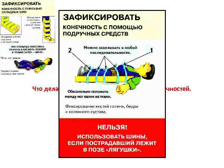 Переломы костей конечностей. Что делать в случаях переломов костей конечностей. 