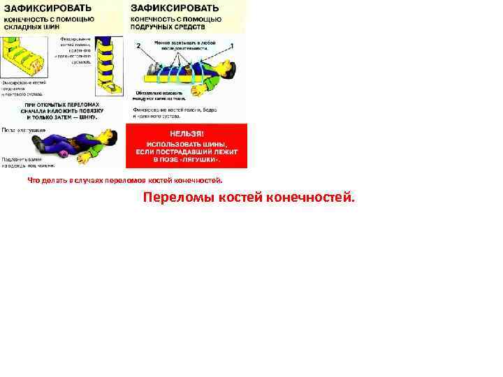 Что делать в случаях переломов костей конечностей. Переломы костей конечностей. 
