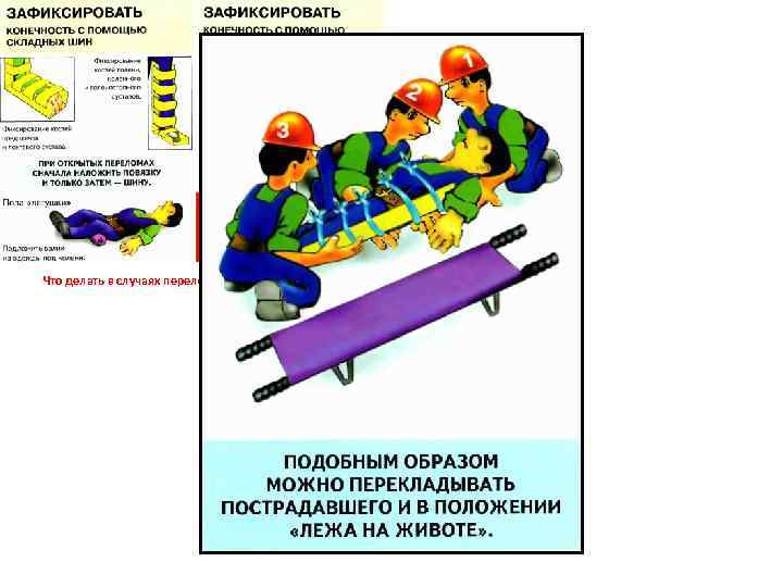 Что делать в случаях переломов костей конечностей. Переломы костей конечностей. 