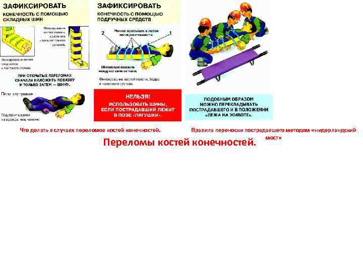 Что делать в случаях переломов костей конечностей. Правила переноски пострадавшего методом «нидерландский мост» Переломы