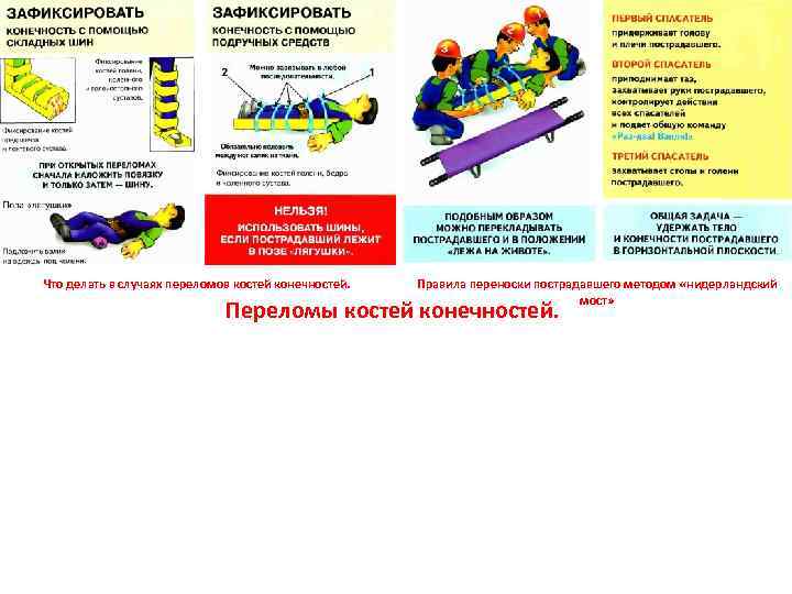 Что делать в случаях переломов костей конечностей. Правила переноски пострадавшего методом «нидерландский мост» Переломы