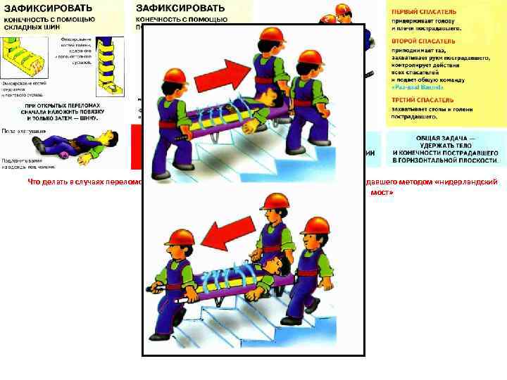 Что делать в случаях переломов костей конечностей. Правила переноски пострадавшего методом «нидерландский мост» Переломы