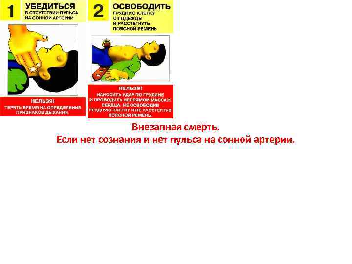 Внезапная смерть. Если нет сознания и нет пульса на сонной артерии. 