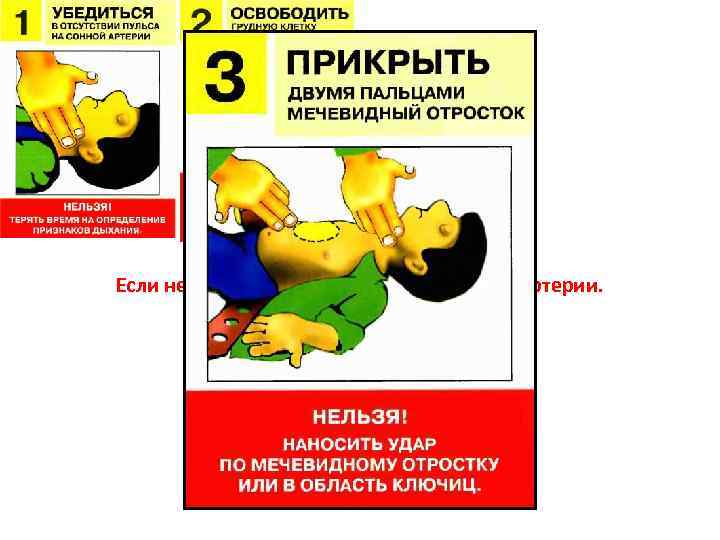 Внезапная смерть. Если нет сознания и нет пульса на сонной артерии. 