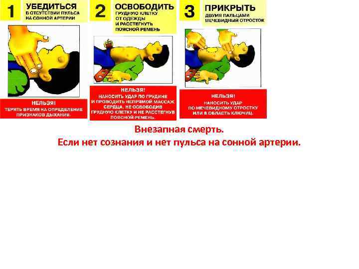 Внезапная смерть. Если нет сознания и нет пульса на сонной артерии. 