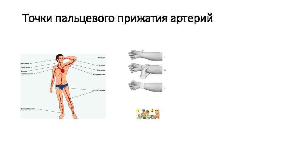  Точки пальцевого прижатия артерий 