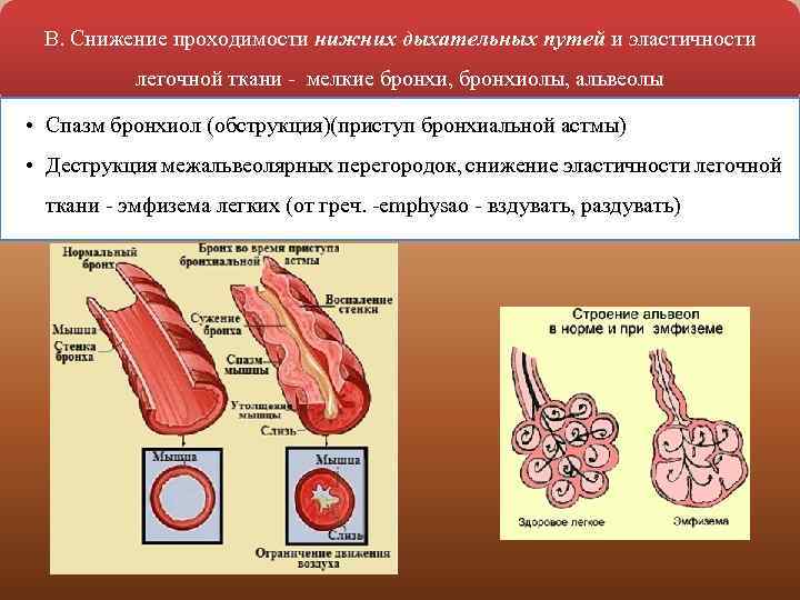 В. Снижение проходимости нижних дыхательных путей и эластичности легочной ткани мелкие бронхи, бронхиолы, альвеолы