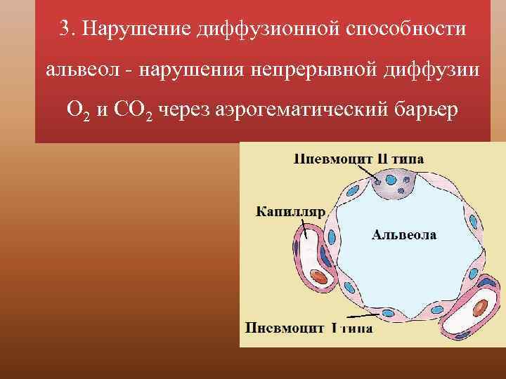 3. Нарушение диффузионной способности альвеол нарушения непрерывной диффузии О 2 и СО 2 через