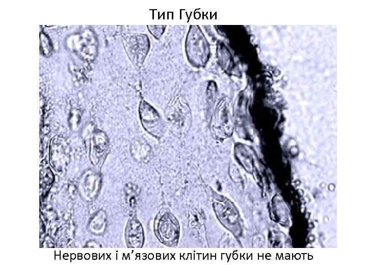 Тип Губки Нервових і м’язових клітин губки не мають 
