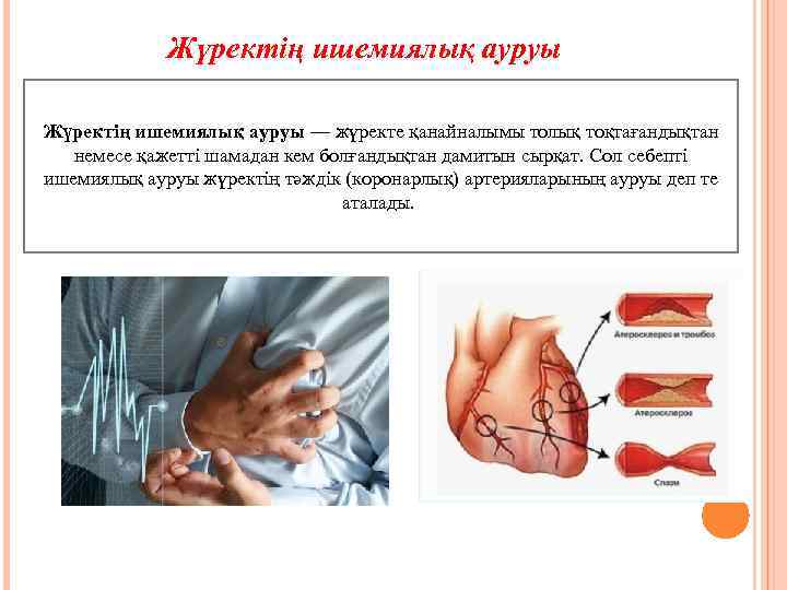 Жүрек аурулары презентация