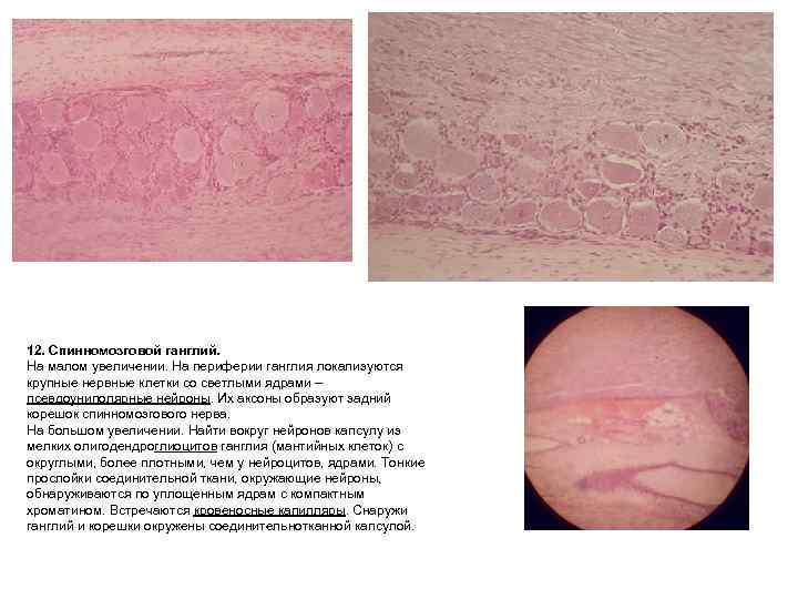 12. Спинномозговой ганглий. На малом увеличении. На периферии ганглия локализуются крупные нервные клетки со