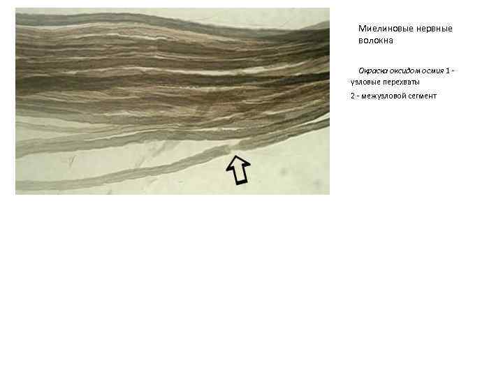 Миелиновые нервные волокна Окраска оксидом осмия 1 - узловые перехваты 2 - межузловой сегмент