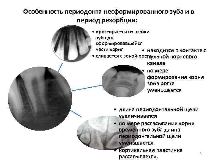 Несформированное изображение это