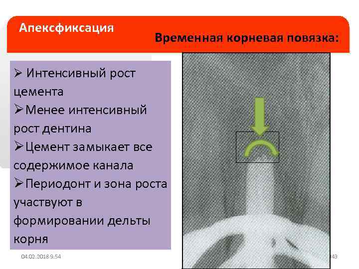 Апексогенез и апексификация презентация