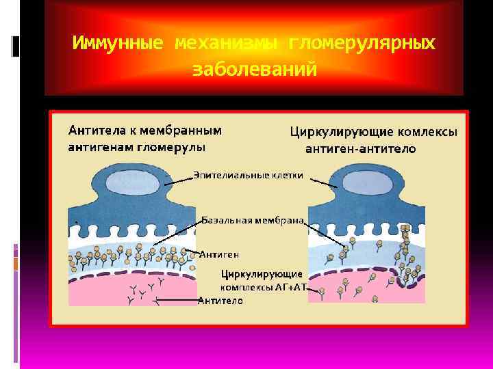 Иммунные механизмы гломерулярных  заболеваний 