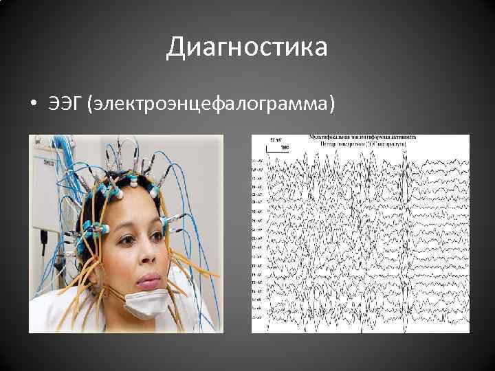 Диагностика • ЭЭГ (электроэнцефалограмма) Диагностика • ЭЭГ (электроэнцефалограмма)