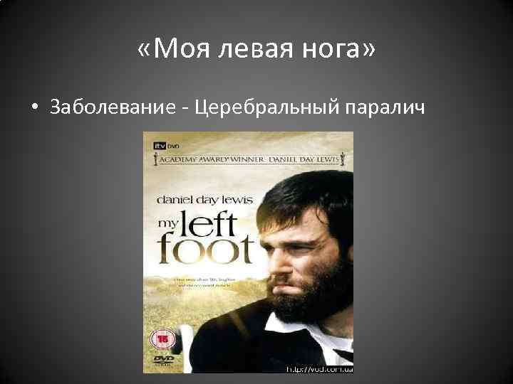 «Моя левая нога» • Заболевание - Церебральный паралич «Моя левая нога» • Заболевание - Церебральный паралич