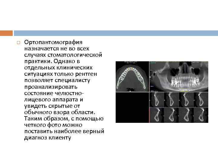 Описание рентгена зуба. Панорамная рентгенография и ортопантомография отличия. Описание рентгеновских снимков зубов.