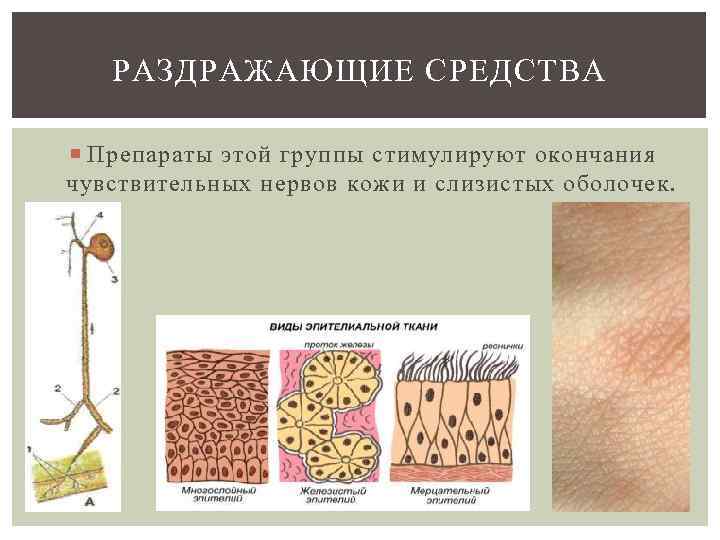   РАЗДРАЖАЮЩИЕ СРЕДСТВА  Препараты этой группы стимулируют окончания чувствительных нервов кожи и