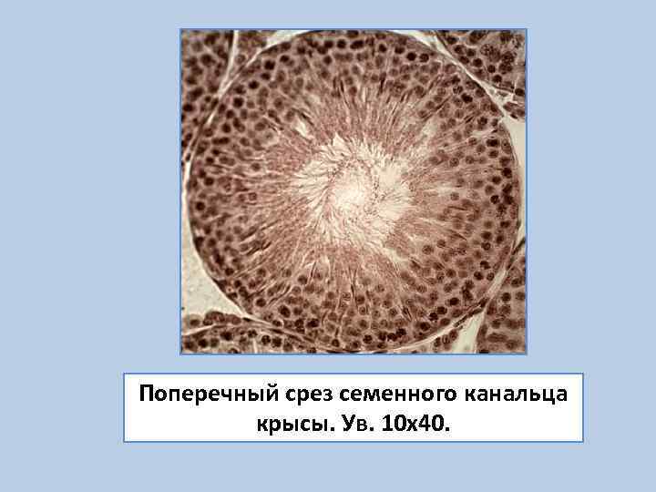 Поперечный срез семенного канальца   крысы. Ув. 10 х40. 