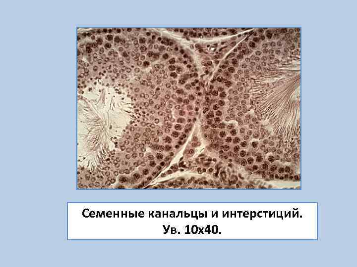 Семенные канальцы и интерстиций.   Ув. 10 х40. 
