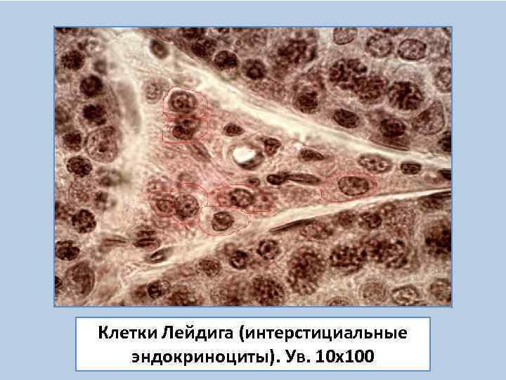 Клетки лейдига. Клетки Сертоли и клетки Лейдига. Семенник гистология клетки Лейдига. Интерстициальная клетка Лейдига. Интерстициальные эндокриноциты Лейдига.