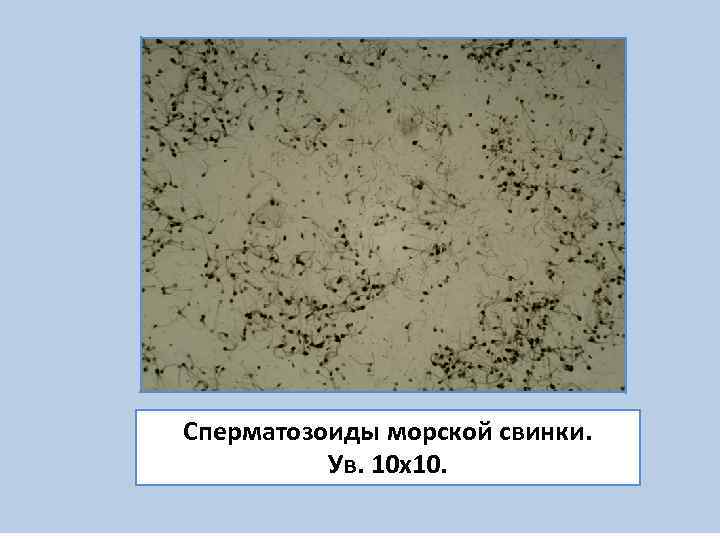 Сперматозоиды морской свинки.  Ув. 10 х10. 