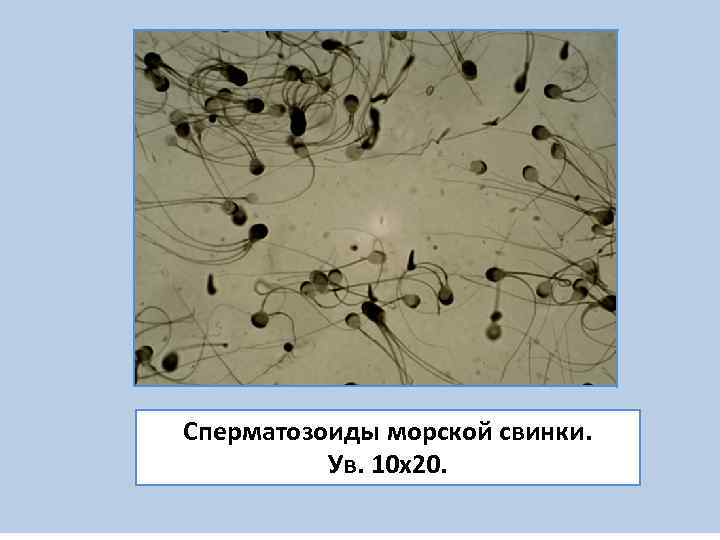 Сперматозоиды морской свинки.  Ув. 10 х20. 