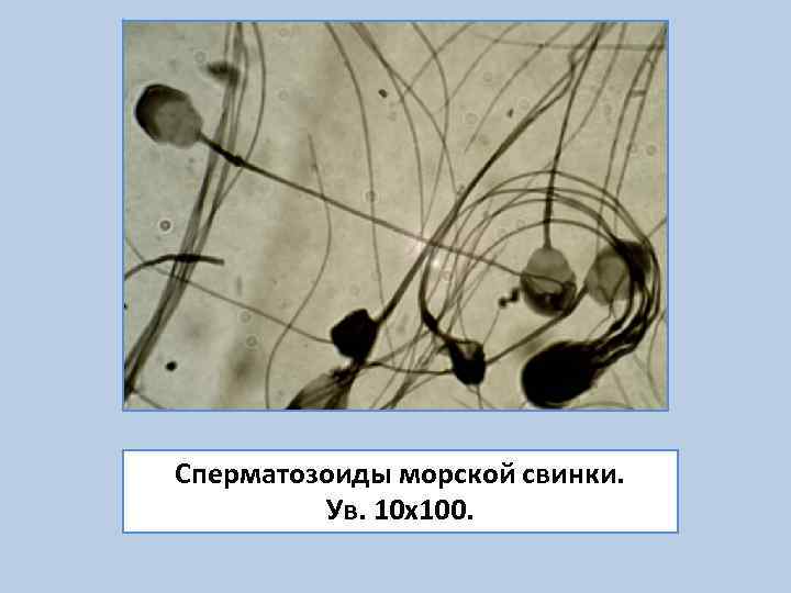 Сколько дней живут спермики в организме женщины. Спермий морской свинки. Строение сперматозоида морской свинки. Где образуются сперматозоиды.