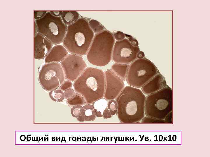 Общий вид гонады лягушки. Ув. 10 х10 