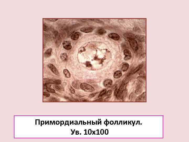 Примордиальный фолликул.   Ув. 10 х100 