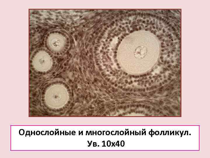 Однослойные и многослойный фолликул.    Ув. 10 х40 