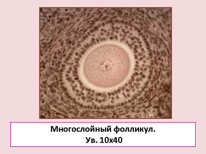 Многослойный фолликул.   Ув. 10 х40 