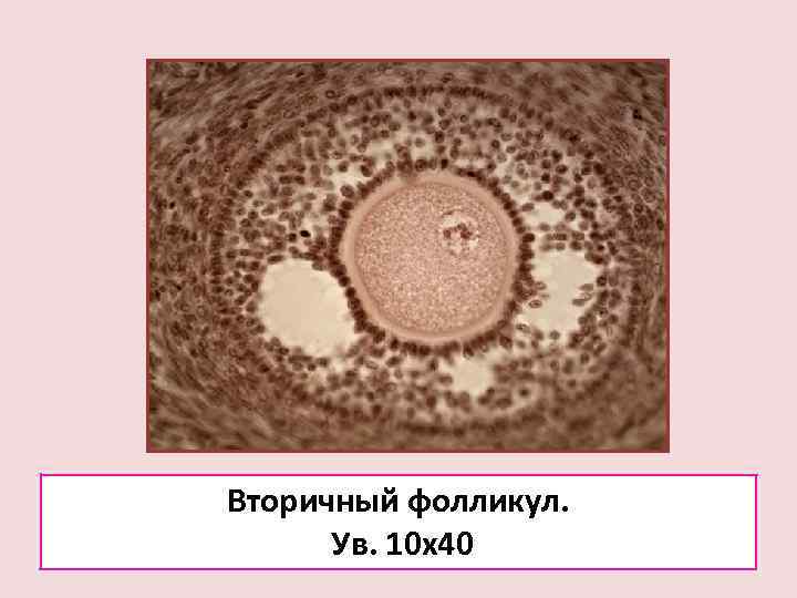 Вторичный фолликул.  Ув. 10 х40 