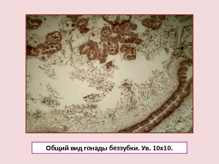 Общий вид гонады беззубки. Ув. 10 х10. 