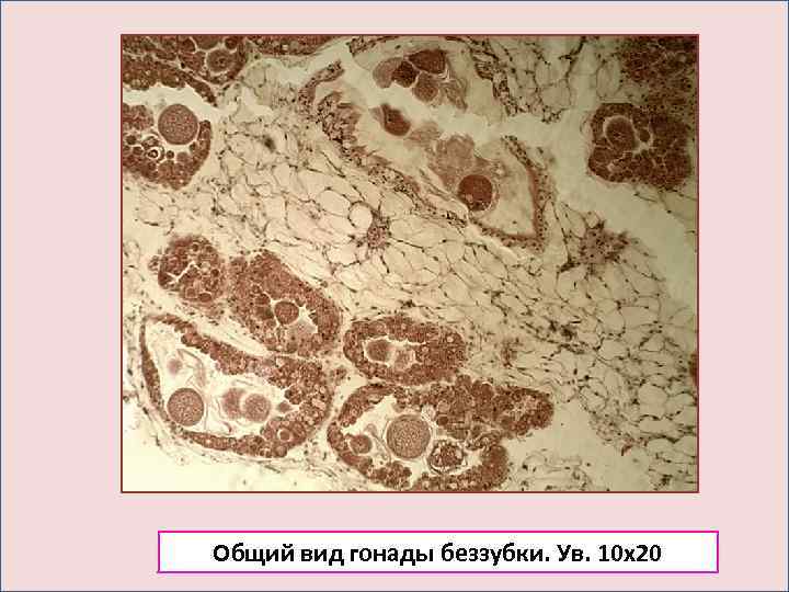 Общий вид гонады беззубки. Ув. 10 х20 