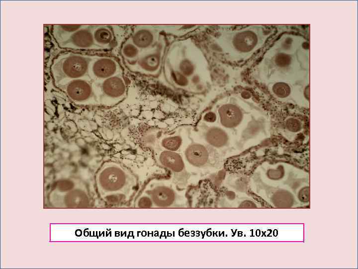 Общий вид гонады беззубки. Ув. 10 х20 