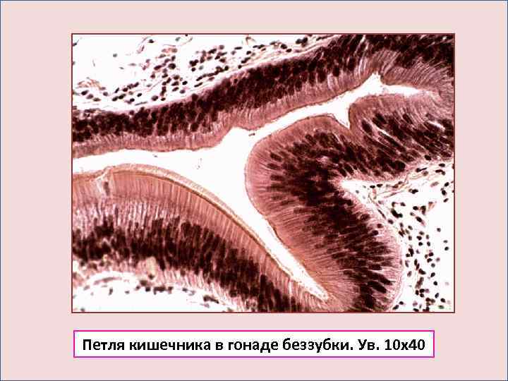 Петля кишечника в гонаде беззубки. Ув. 10 х40 