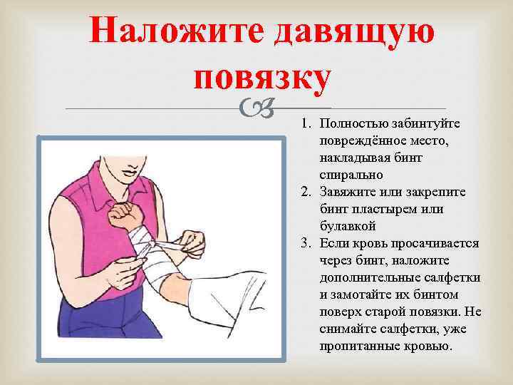 Наложите давящую повязку   1. Полностью забинтуйте   повреждённое место,  