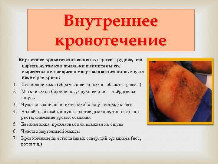      Внутреннее     кровотечение   