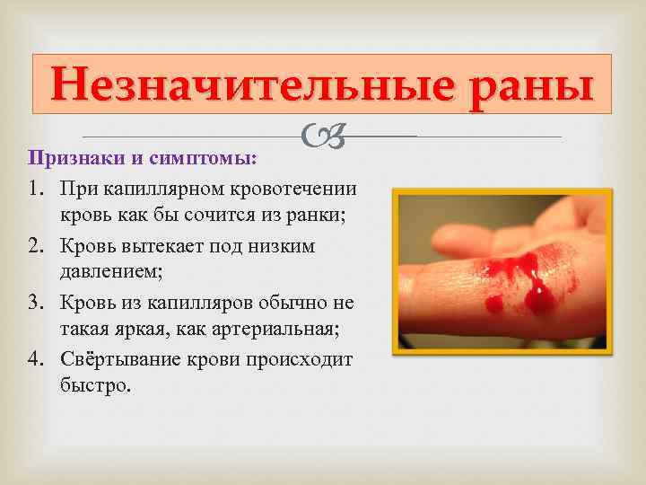  Незначительные раны Признаки и симптомы:     1. При капиллярном кровотечении