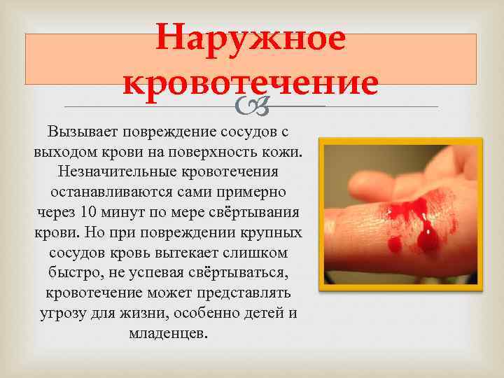   Наружное  кровотечение     Вызывает повреждение сосудов с выходом