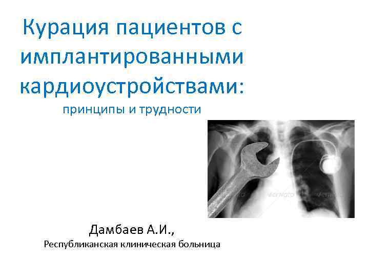 Курация пациентов с имплантированными кардиоустройствами:  принципы и трудности    Дамбаев А.