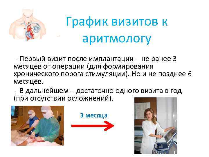    График визитов к   аритмологу - Первый визит после имплантации