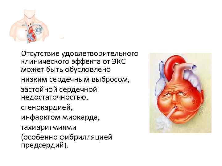 Отсутствие удовлетворительного клинического эффекта от ЭКС может быть обусловлено низким сердечным выбросом,  застойной
