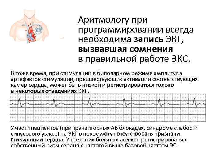     Аритмологу при     программировании всегда  