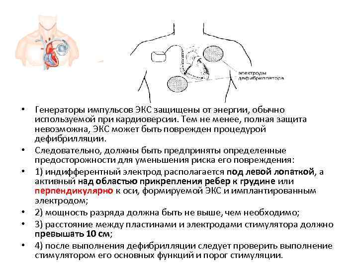  • Генераторы импульсов ЭКС защищены от энергии, обычно  используемой при кардиоверсии. Тем