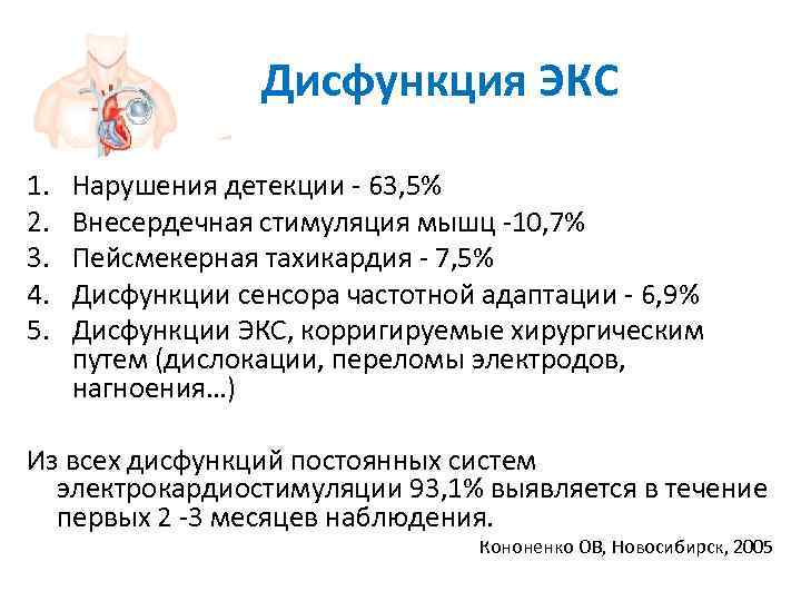    Дисфункция ЭКС 1.  Нарушения детекции - 63, 5% 2. 